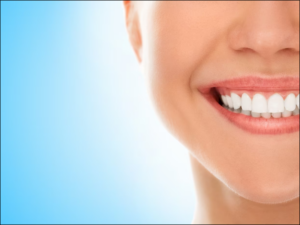 professional teeth whitening