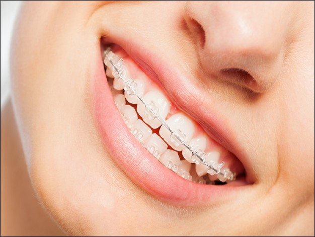 Teeth misalignment